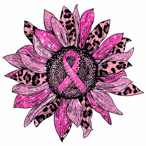 Breast Cancer677